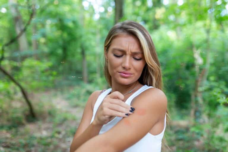 por qué me pican tanto los mosquitos en verano